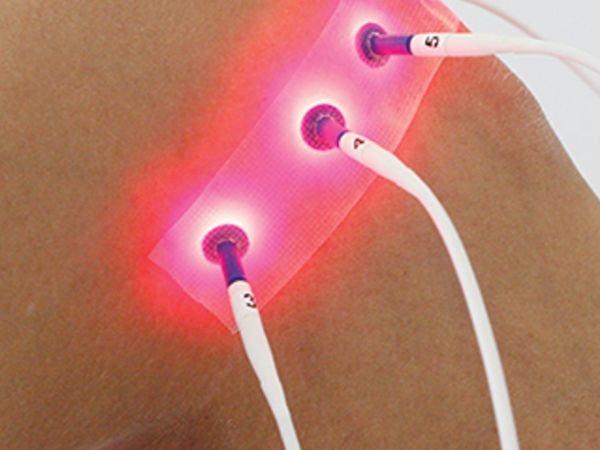 Laserakupunktur – Innovativ, effizient, schmerzfrei